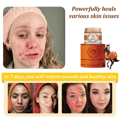 [Official Brand Store🎉]2025 New Horse Oil Therapy Cream (👨‍⚕NZDS 𝐑𝐄𝐂𝐎𝐌𝐌𝐄𝐍𝐃𝐒)